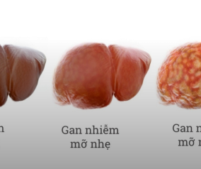 10 BÍ QUYẾT DƯỠNG SINH NỘI TẠNG QUAN TRỌNG ĐỂ SỐNG KHỎE MẠNH